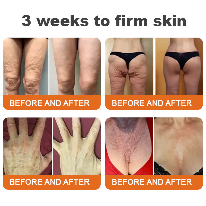🏆Seurico™ Instant Wrinkle-Free Bee Toxin Cream | FINAL HOURS – 80% FLASH SALE!