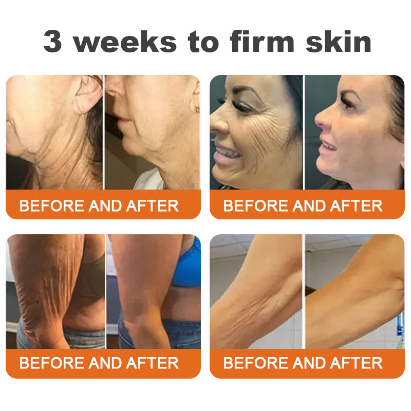 🏆Seurico™ Instant Wrinkle-Free Bee Toxin Cream | FINAL HOURS – 80% FLASH SALE!