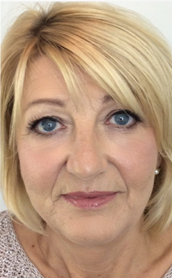 <em>Laura F.</em>