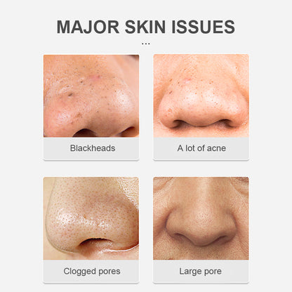 Seurico™ Blackhead Removal Nose Mask - Intense Cleansing, Sensitive Skin-Friendly