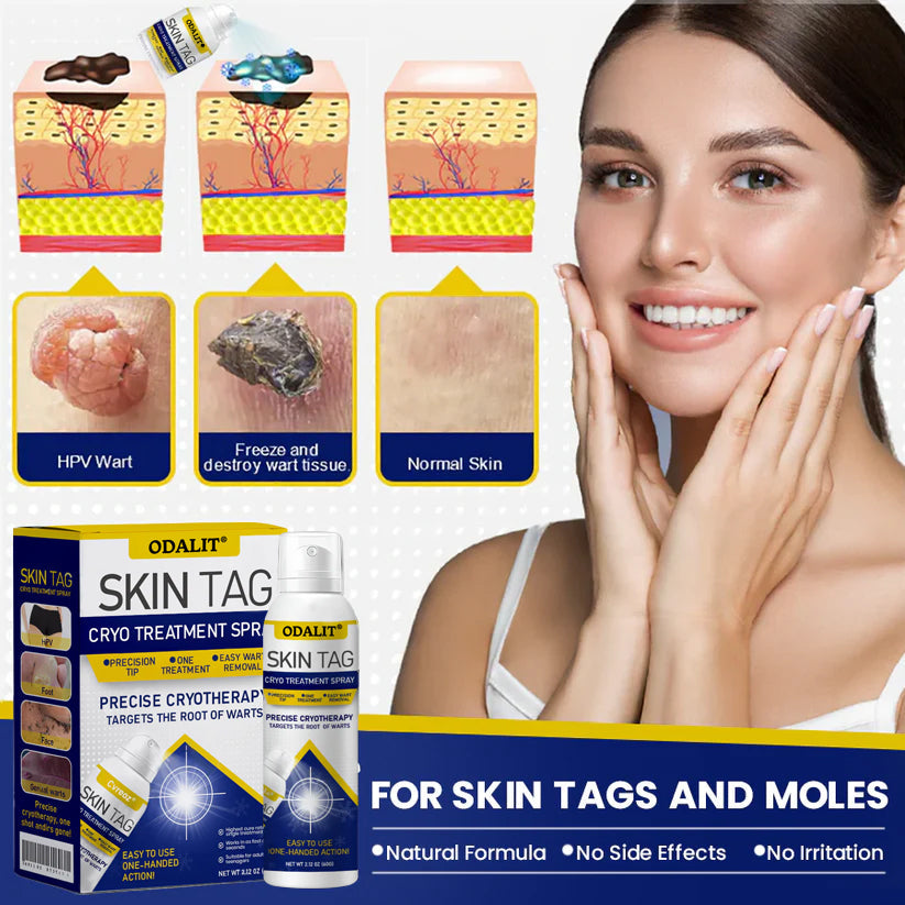 ❄️ ODALIT®: The Dermatologist-Grade Spray That Freezes Away Skin Tags & Warts.
