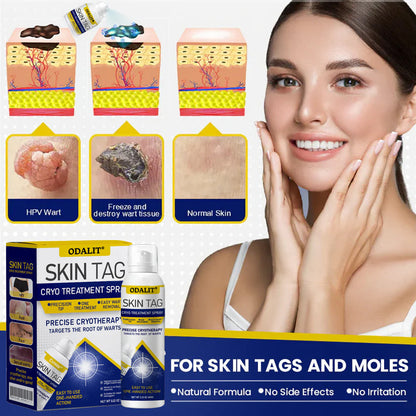❄️ ODALIT®: The Dermatologist-Grade Spray That Freezes Away Skin Tags & Warts.