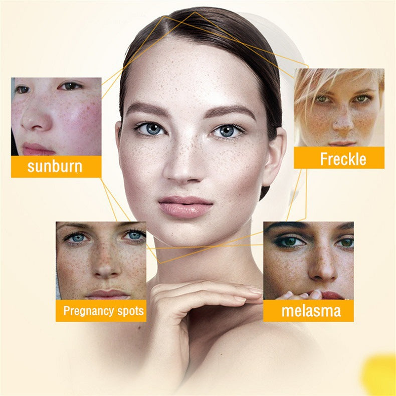 ✨ [Official Store] LBMLBM™ Blemish Removing Beauty Cream – Fade Dark Spots, Freckles & Wrinkles 💫 Restore a Radiant, Even-Toned Glow!