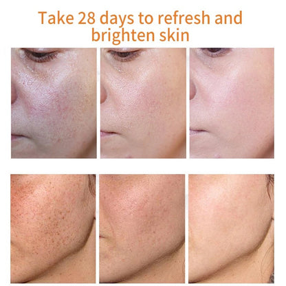 ✨ [Official Store] LBMLBM™ Blemish Removing Beauty Cream – Fade Dark Spots, Freckles & Wrinkles 💫 Restore a Radiant, Even-Toned Glow!