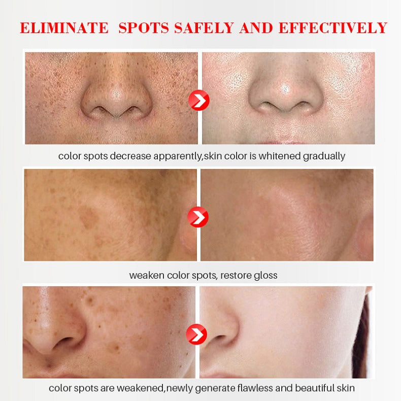 ✨ [Official Store] LBMLBM™ Blemish Removing Beauty Cream – Fade Dark Spots, Freckles & Wrinkles 💫 Restore a Radiant, Even-Toned Glow!