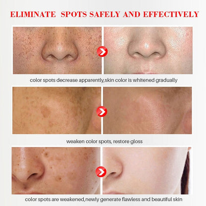 ✨ [Official Store] LBMLBM™ Blemish Removing Beauty Cream – Fade Dark Spots, Freckles & Wrinkles 💫 Restore a Radiant, Even-Toned Glow!