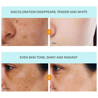 ✨ [Official Store] LBMLBM™ Blemish Removing Beauty Cream – Fade Dark Spots, Freckles & Wrinkles 💫 Restore a Radiant, Even-Toned Glow!